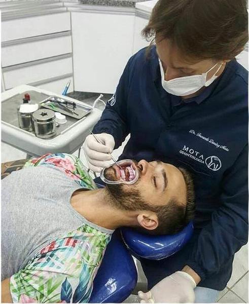 Clareamento dental: as 6 maiores dúvidas sobre o assunto | Foto: Divulgação