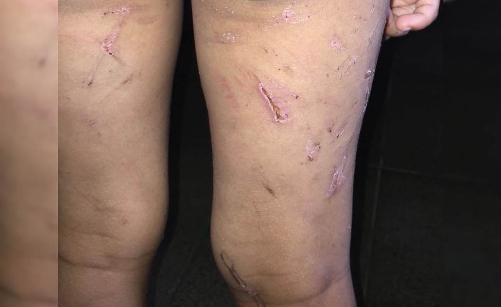 Criança era vítima de tortura, surra com fios e castigos em Niquelândia | Foto: Divulgação/ Polícia Civil