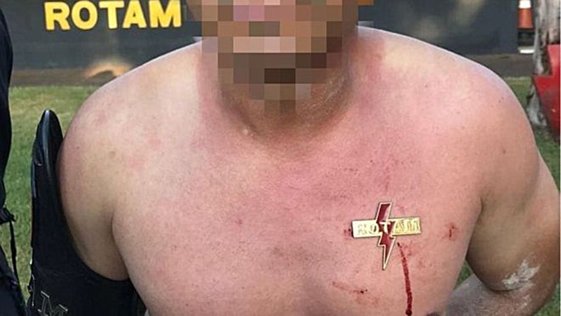 BBC repercute aluno de curso da Rotam que teve brasão cravado no peito | Foto: Reprodução/BBC