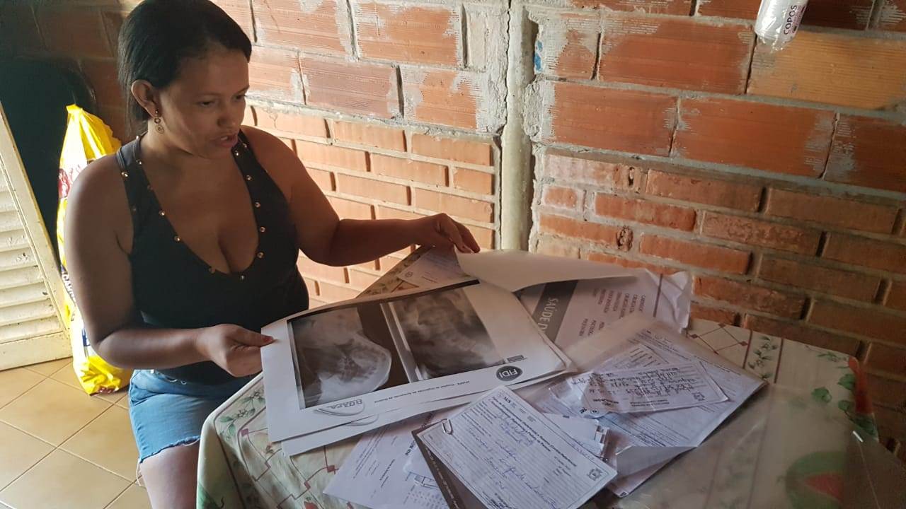 Dona de casa Valquíria de Almeida reclama da demora para que a cirurgia seja realizada | Foto: Folha Z