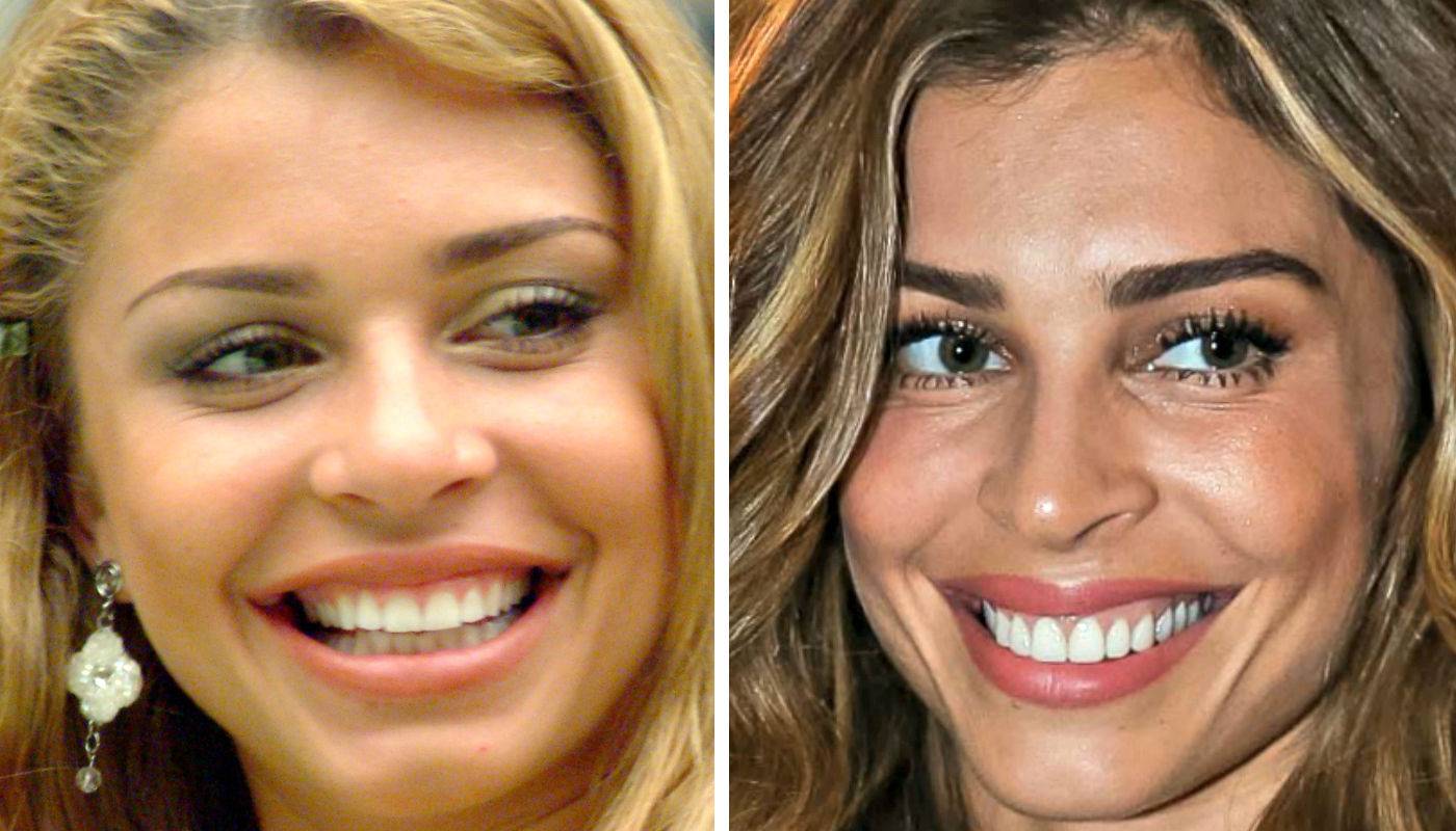 Veja tudo o que precisa saber antes de colocar facetas dentárias em Goiânia. A atriz Grazi Massafera já passou pelo procedimento| Foto: Reprodução
