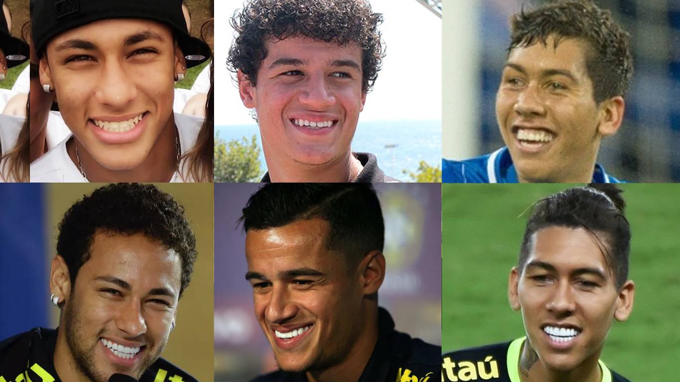 Confira o antes e depois das facetas dentais nos jogadores da Seleção Brasileira Neymar, Philippe Coutinho e Roberto Firmino | Foto: Montagem