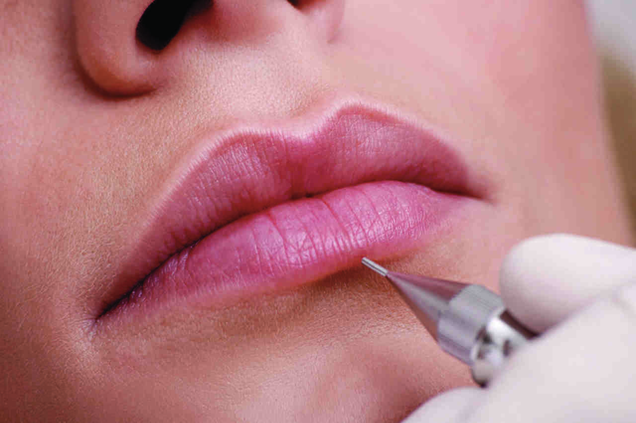 Dermógrafo entra em ação com o contorno dos lábios e depois preenchimento completo, que leva em torno de uma hora