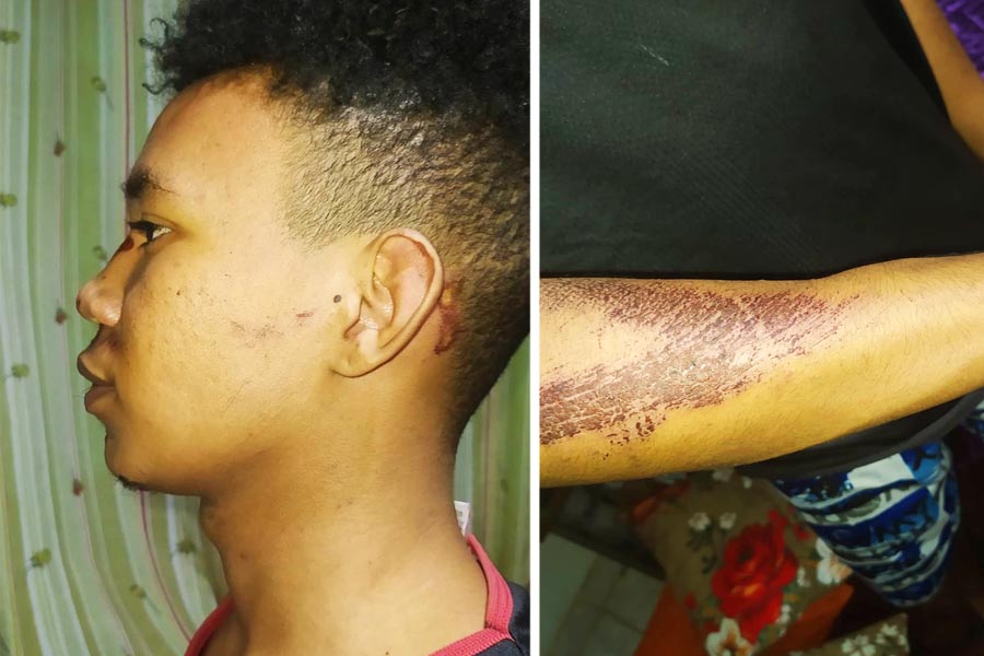 Daniel Ribeiro perdeu grande parte dos dentes do lado direito da boca, teve a mandíbula danificada e precisou de 17 pontos no rosto | Foto: Reprodução